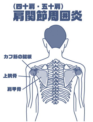ローてーたかふ.gif