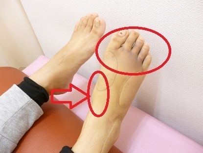 ３日治療前.JPG